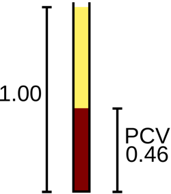 2000px-Packed_cell_volume_diagram