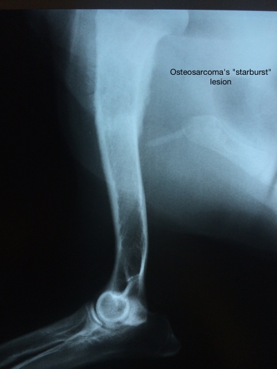 Radiograph of Irma's bone cancer